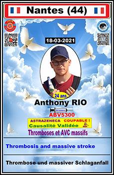 Dcd anthony qrc