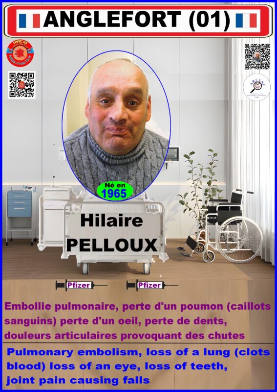 01 - Hilaire