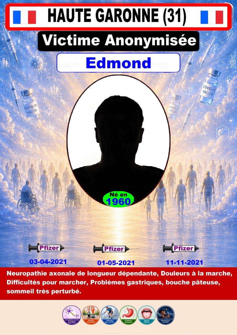 31 - Edmond@