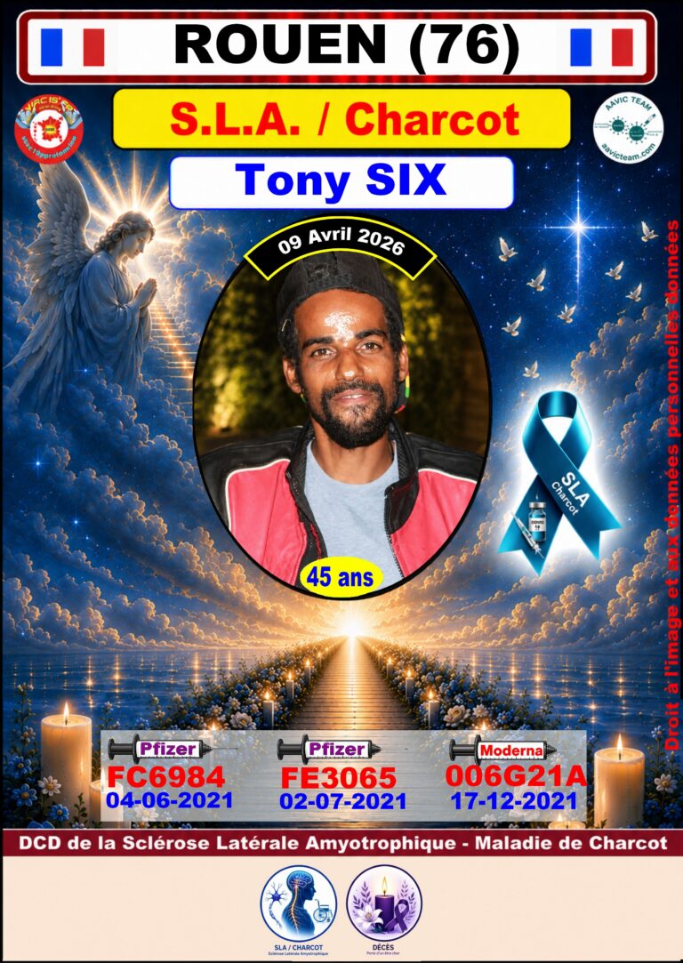 76 - Tony@